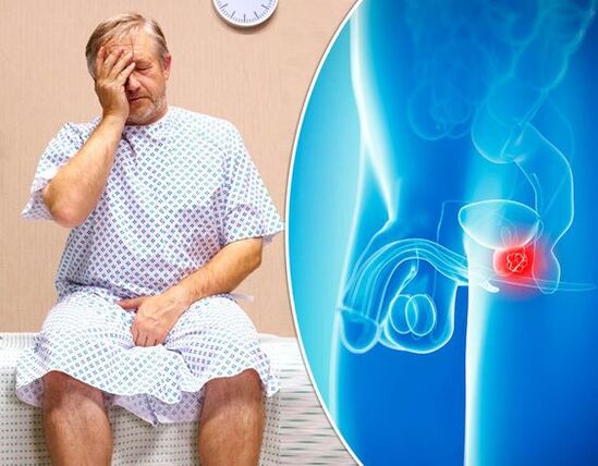 Symptome einer Prostatitis
